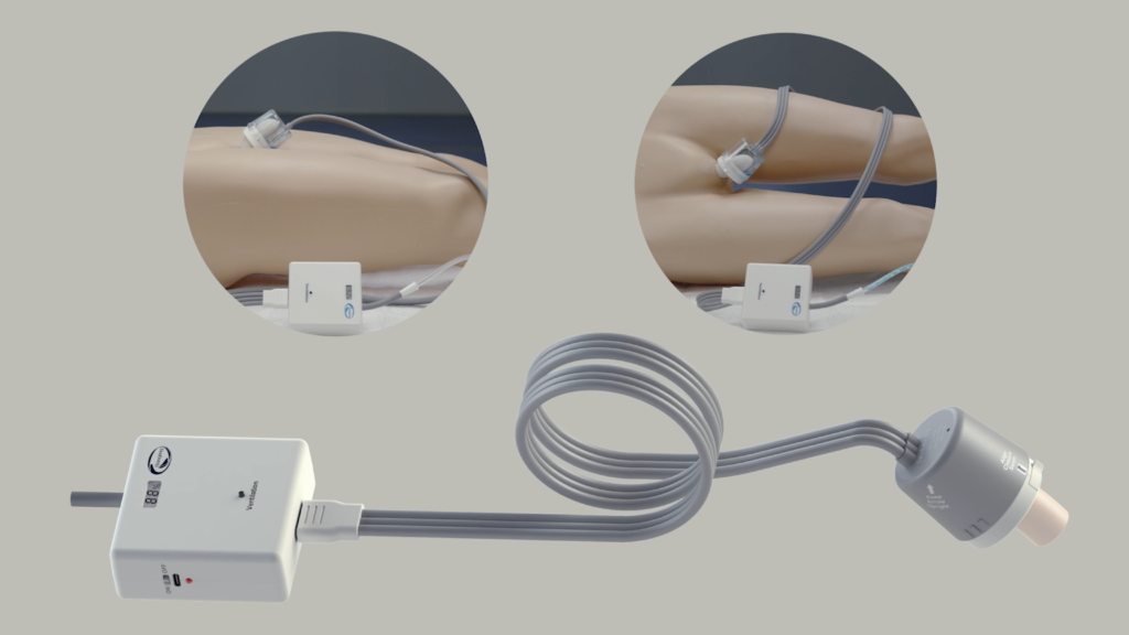 automatic urine collection system
